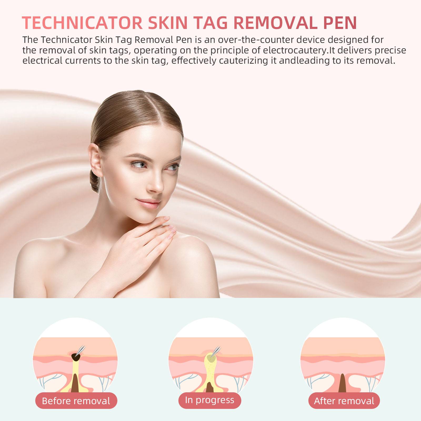 Technicator Skin Tag Remover Pen